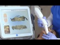 iTero Element® Orthodontic Training Video