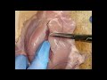 Subcuticular suture on a Chicken (SATISFYING)