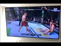 Mcgregor breaks leg on Poirier's elbow