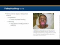 EMT Lecture: Allergy and Anaphylaxis