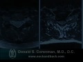 How to Read a MRI of Cervical Nerve Compression | Neck Pain | Colorado Spine Surgeon