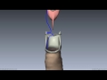 Larynx - Ligaments, Membranes, Vocal Cords - 3D Anatomy Tutorial