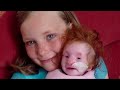 The Tiniest Girl in the World: The Full Documentary | A True Story