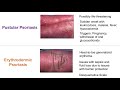 Overview of Psoriasis | What Causes It? What Makes It Worse? | Subtypes and Treatment