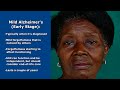 Alzheimer's Disease (Dementia) Nursing: Symptoms, Treatment, Stages, Pathophysiology NCLEX