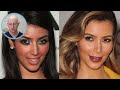 What Happened to Kim Kardashian's Face? | Plastic Surgery Analysis