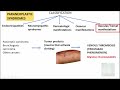 NEOPLASIA Part 10: CLINIAL EFFECTS OF  CANCER: Cancer Cachexia, Paraneoplastic syndromes