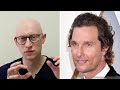 Matthew McConaughey Hair Transplants | Surgeon Reacts