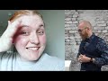 SHE BLEACHED HER HAIR 4 TIMES IN 24H  - hairdresser reacts to hair fails #hair #beauty #hair #beauty