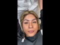 Microblading Eyebrow Mapping - Episode 16