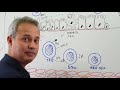 Asthma - Pathophysiology