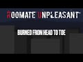 Roommate Unpleasant: Burned from Head to Toe