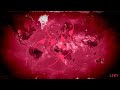 Adverse Reactions (Plague Inc OST)