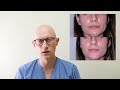 Why I Stopped Filling Tear Troughs... | Surgeon Reacts