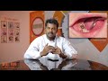 Quality Root canal treatment in Chennai /Pondicherry(Call or WhatsApp 9840401520)Must Watch!  #PS2