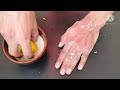 Eliminate Cracked Heels and get White and Smooth Feet / Magic Cracked Heels home remedy