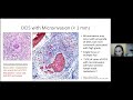 DCIS - A Pathologist's Perspective | 2023 Ductal Carcinoma In Situ Patient Forum