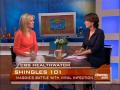 Shingles Virus Explained