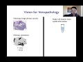 Computer Vision to Phenotype Human Diseases Across Physiological and Molecular Scales - James Zou