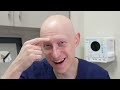 Hair Loss Drug to Cure MY BALDNESS | Alopecia Areata Cure