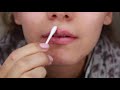 HOW TO : Cure a cold sore FAST | Healed & Scab Free