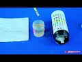 Urine analysis test procedure : Biochemistry Practicals