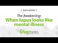 The Expert Series: The Awakening: When lupus looks like mental illness