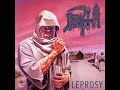 Leprosy