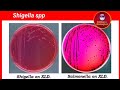 Shigella dysenteriae (Shigellosis, Food poisoning) شرح بالعربي