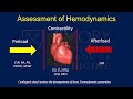 Cardiogenic Shock