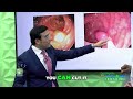 Discover the Secret to Preventing Colon Cancer  A Closer Look Inside the Colon