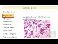 LIPOMA : Gross & Microscopy, Types and variants