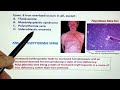 HAEMATOLOGY NEXT - 1 ( Part 1 ) | DR. PROFESSOR MRIDUL MEHROTRA MBBS:MD (KGMU) | M M SIR