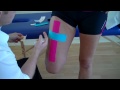 How to apply Kinesiology Taping for a strain of the Rectus Femoris / Quadricep muscle strain