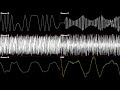Sonic Spinball - Options - Oscilloscope Deconstruction
