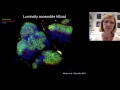 Listeria monocytogenes: A multifaceted model... and a reference by Pascale Cossart, PhD