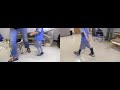 Before and After | strong toe walking | DAFO 3