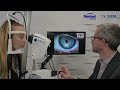 Idra Comprehensive Dry Eye Assessment - Fast Wizard Overview - Reichert AMETEK Eye Care | SBM