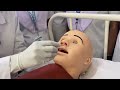 Naso Gastric Tube Insertion Procedure/ Ryle’s tube insertion / Contraindications/ All steps