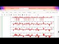 Standardized Precipitation Index (SPI) | Drought & Flood Monitor | Build Your Function in Python