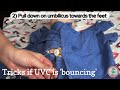 Step-by-Step: Place an Umbilical Venous Catheter!// 6+ TIPS for 