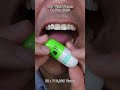 Unwind with the Best Chewing ASMR by Doctor Tristan Peh
